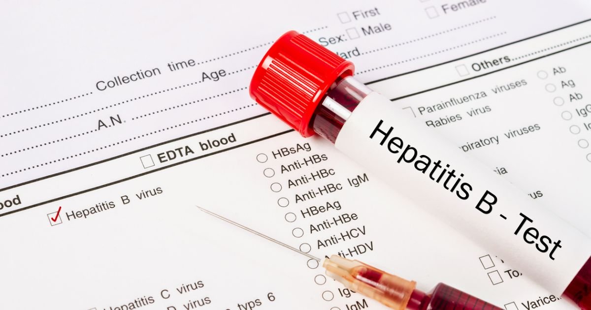 HBV, định lượng HBV, viêm gan B, xét nghiệm viêm gan B
