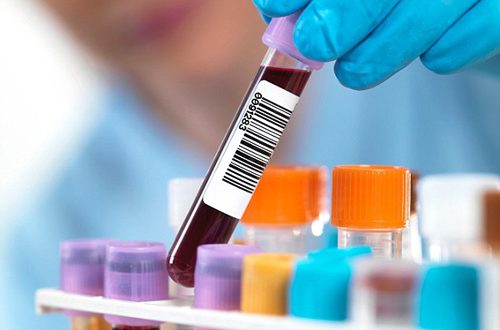 Xét nghiệm ADN huyết thống cần lưu ý những điều gì ?