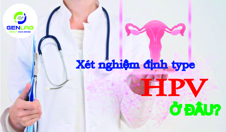 Xét nghiệm định type HPV sàng lọc ung thư cổ tử cung ở đâu tại Hà Nội